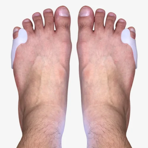 DuraFlex Gel Bunionette Separators